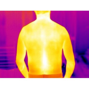 Aplicatii camere termografice in Medicina 